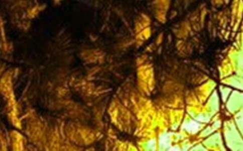 �䰮����Ԥ�����ְ�����